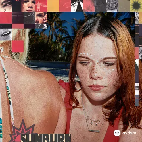 Sunburn